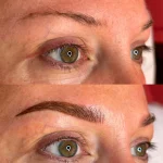 Why no Botox after microblading