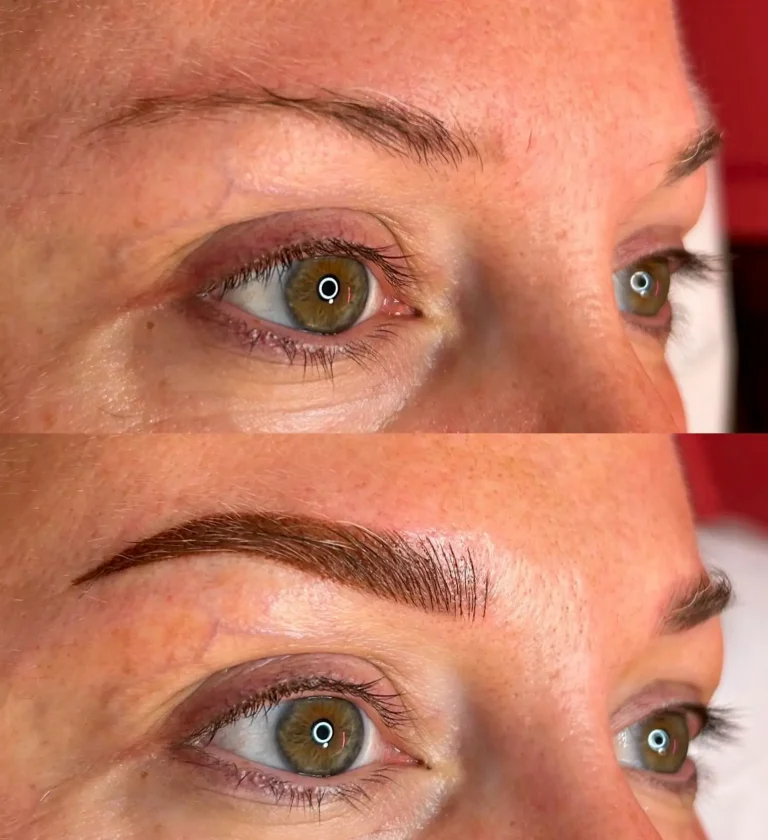 Why no Botox after microblading