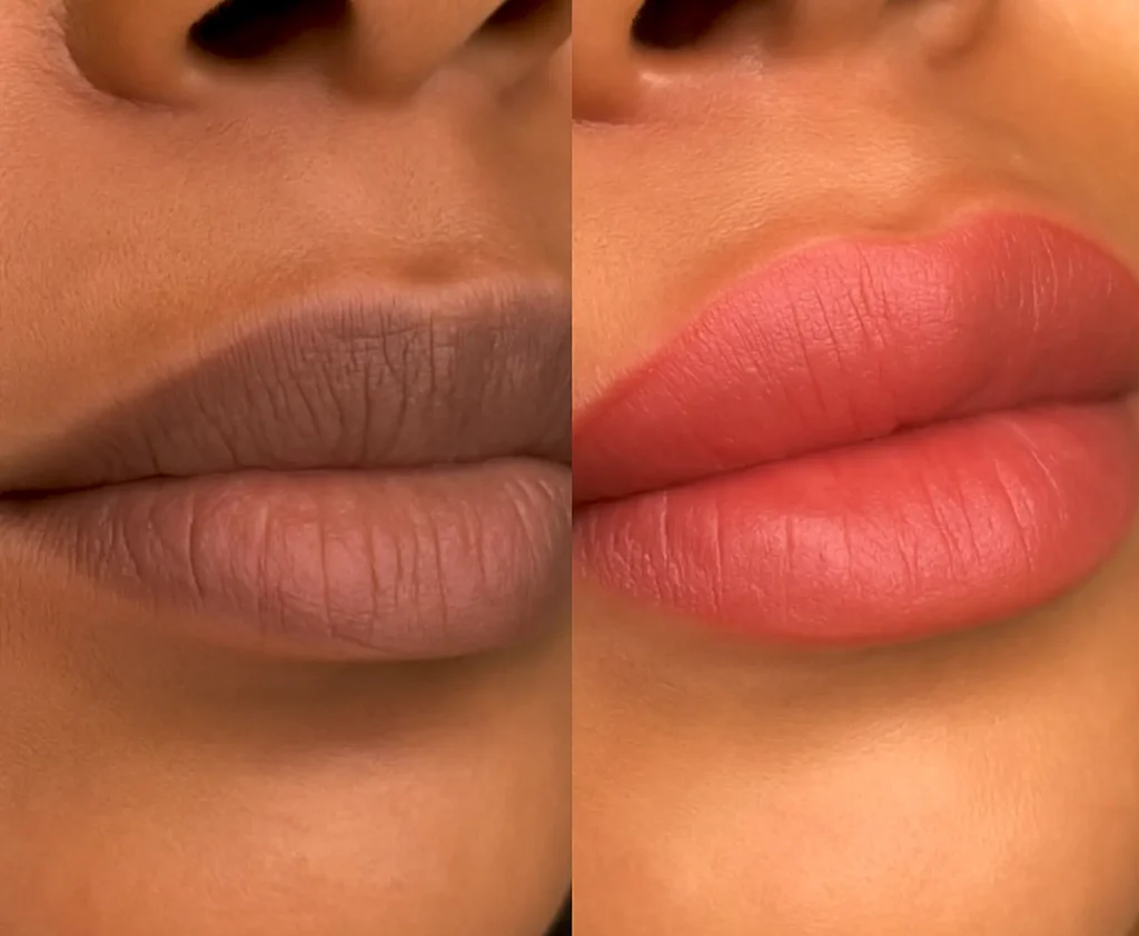cosmetic procedures