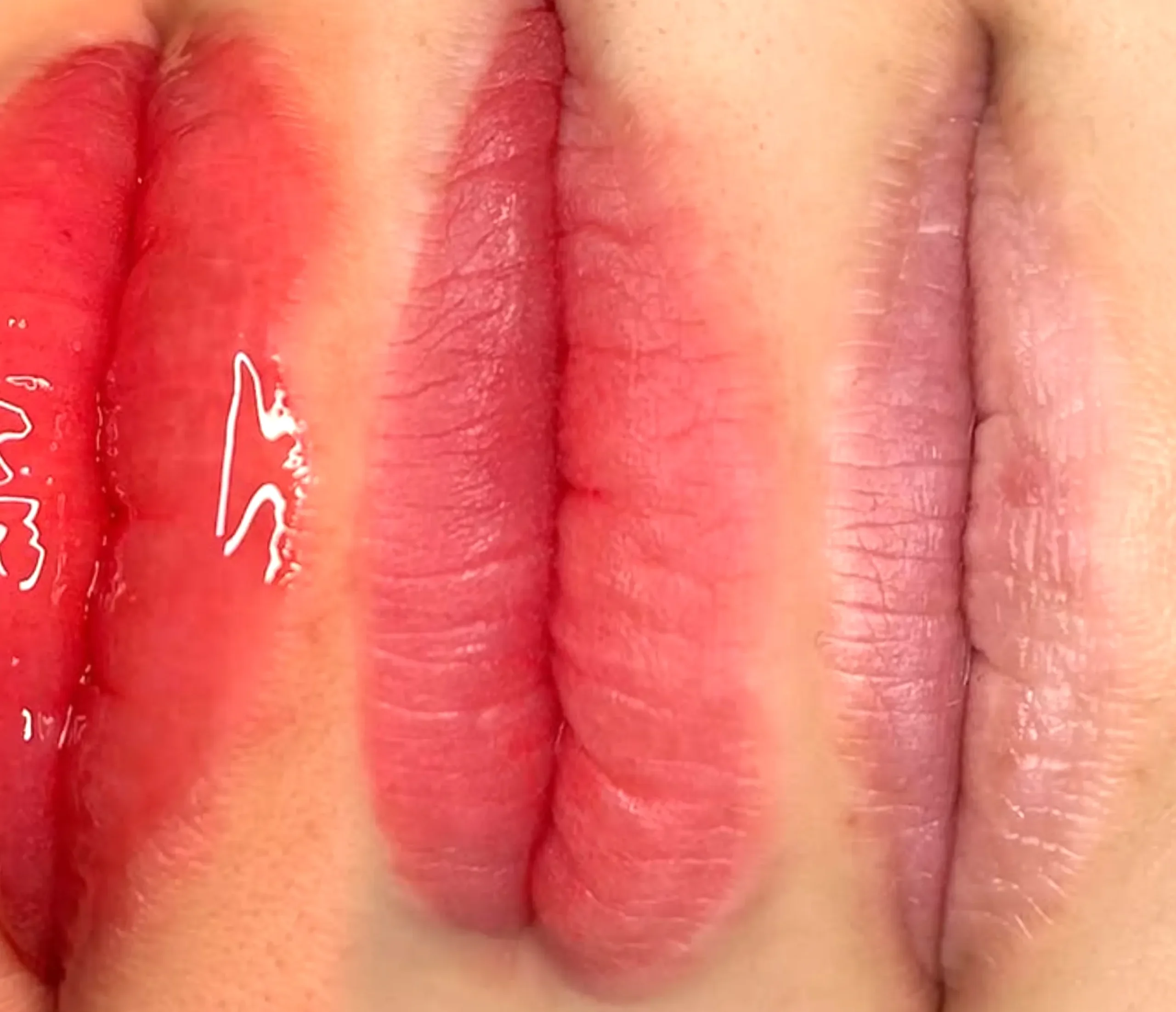 lip blush vs filler